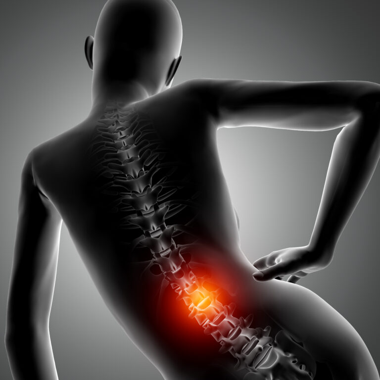 Understanding Low Back Pain (Lumbago): Causes, Treatment, and Prevention