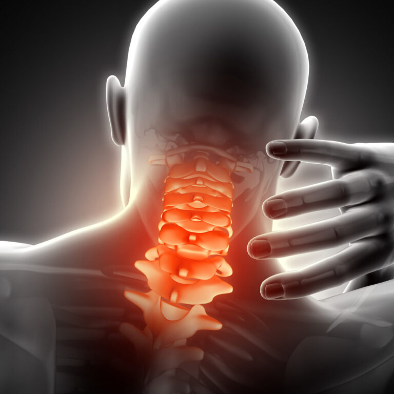 Understanding Cervical Pain: Causes, Treatment, and Prevention